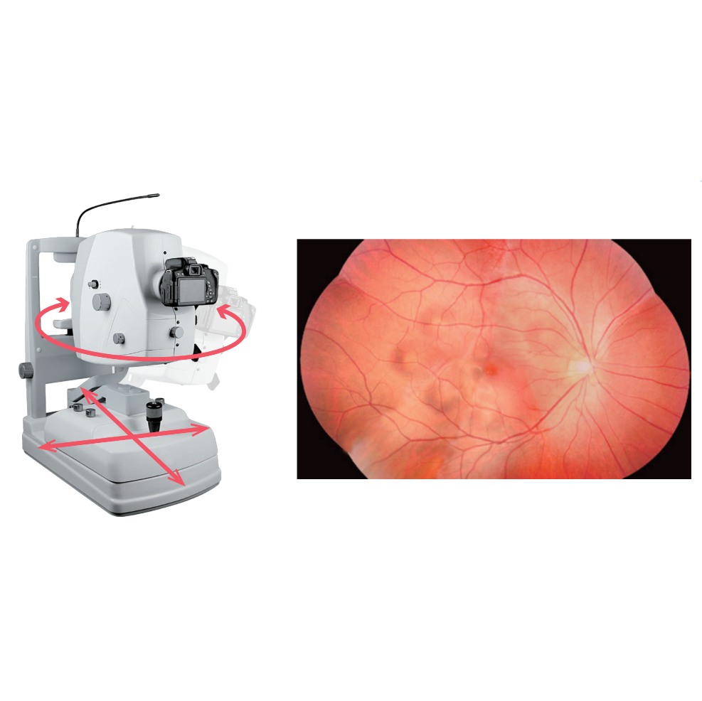 Fundus camera TNF507 FFA